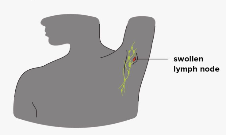 Lymph Nodes